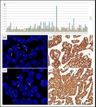 数字PCR：客观、快速且准确检测肺癌ALK状态 —— 曾瑄教授团队新进展！